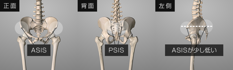 正しい骨盤の位置は横から見た時にASISの位置がPSISより少し低い状態