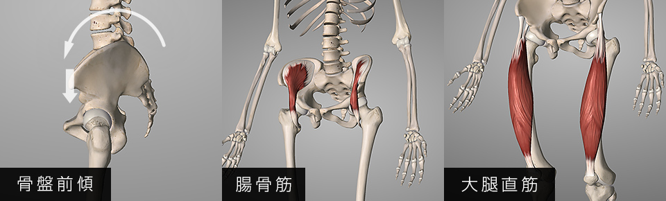 腸骨筋・大腿直筋が硬くなると骨盤は前傾する